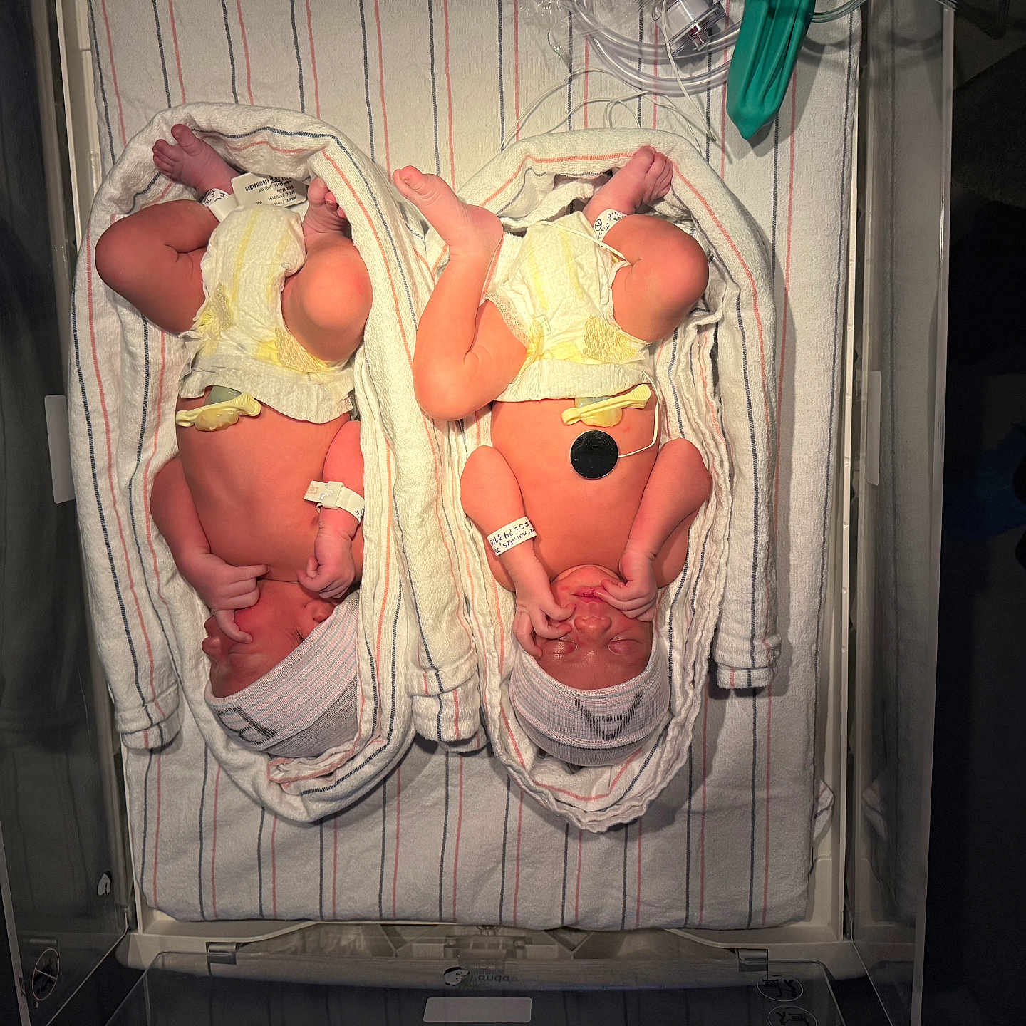 Matthew And Michael is registered to the contest to win money with this photo: baby, bassinet, blanket, diaper, hospital, hospital_crib, infant, knit_hat, medical_equipment, monitor_lead, newborn, nursery, skin, sleeping, striped_sheet, swaddled, tiny_hands, twins, umbilical_clamp, wristband