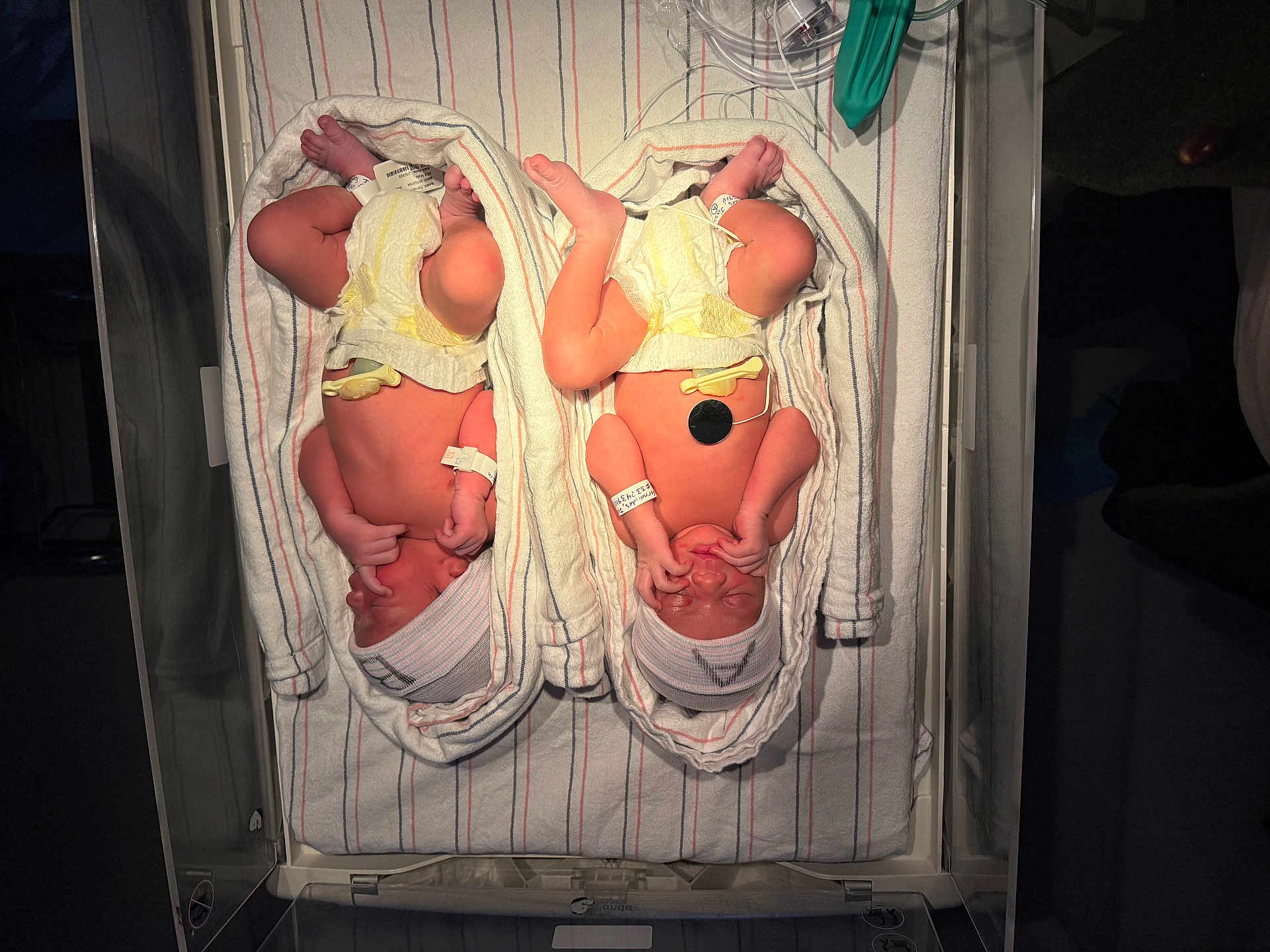 Matthew And Michael is registered to the contest to win money with this photo: baby, bassinet, blanket, diaper, hospital, hospital_crib, infant, knit_hat, medical_equipment, monitor_lead, newborn, nursery, skin, sleeping, striped_sheet, swaddled, tiny_hands, twins, umbilical_clamp, wristband