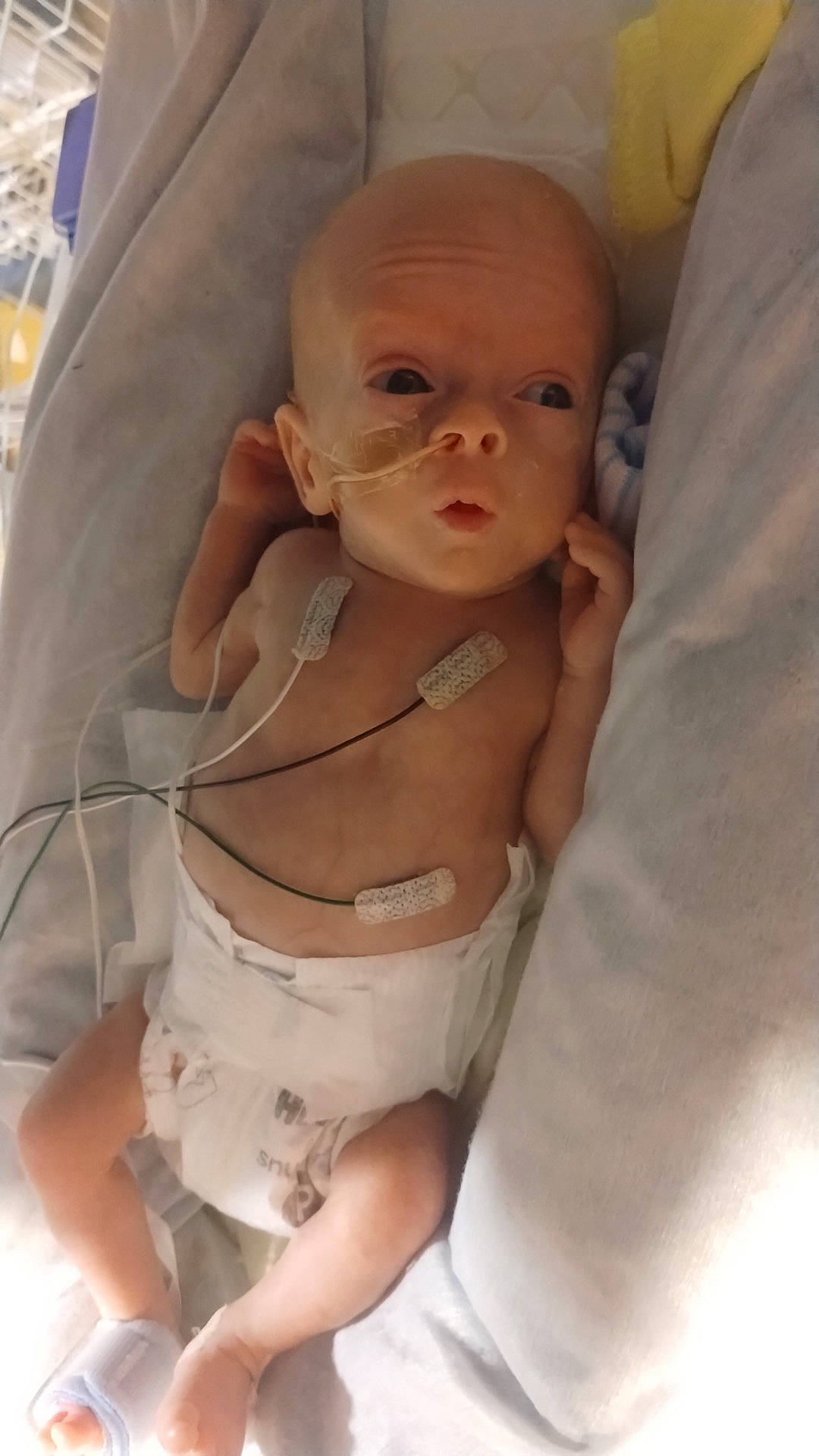 Bentley joined the competition — help win amazing prizes! abdomen, baby, baby_products, baby_safety, baby_toddler_clothing, barechested, cheek, chest, child, comfort, diaper, mouth, nail, navel, person, skin, stomach, thigh, thumb, toddler