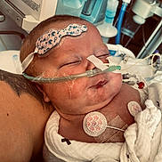 Carter is registered to the contest to win money with this photo: baby, infant, hospital, medical_equipment, nasal_cannula, sensor_pads, blanket, sleeping, patient, healthcare, newborn, face, head, tubes, monitoring, skin, person, resting, care, medical