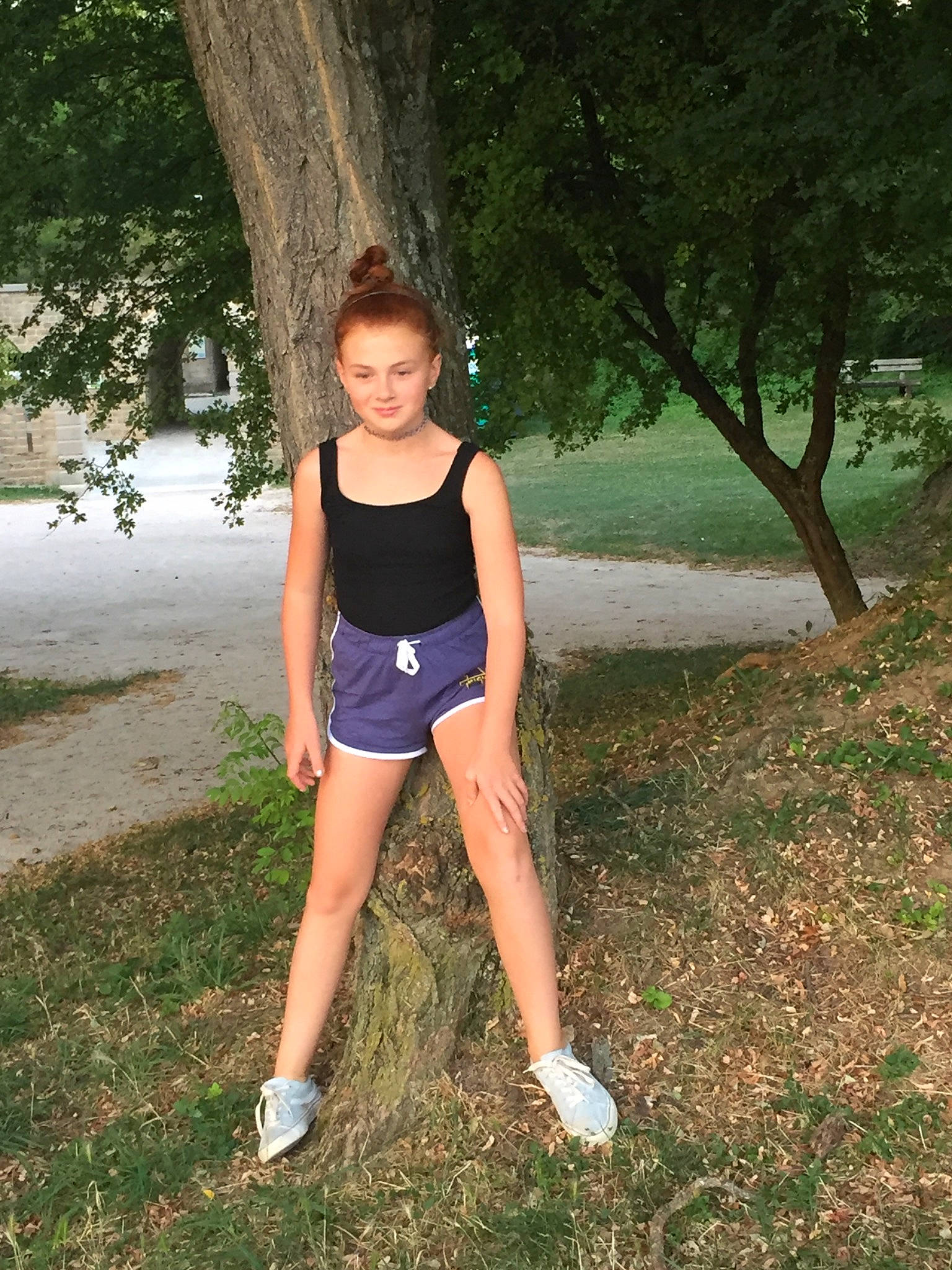 Aglae a rejoint le concours — aidez-le/la à gagner de superbes lots ! fawn, grass, human_leg, joy, knee, leg, leisure, person, plant, shorts, smile, sportswear, summer, thigh, tree, vacation