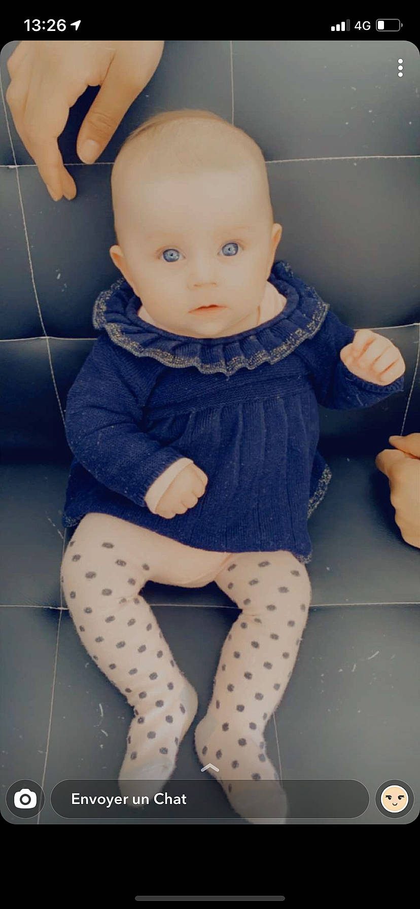Giulia participe au concours pour gagner de l'argent avec cette photo : arm, baby_toddler_clothing, doll, eye, finger, hand, head, human_body, iris, joint, knee, lip, neck, person, shoulder, skin, sleeve, thigh, thumb, toy