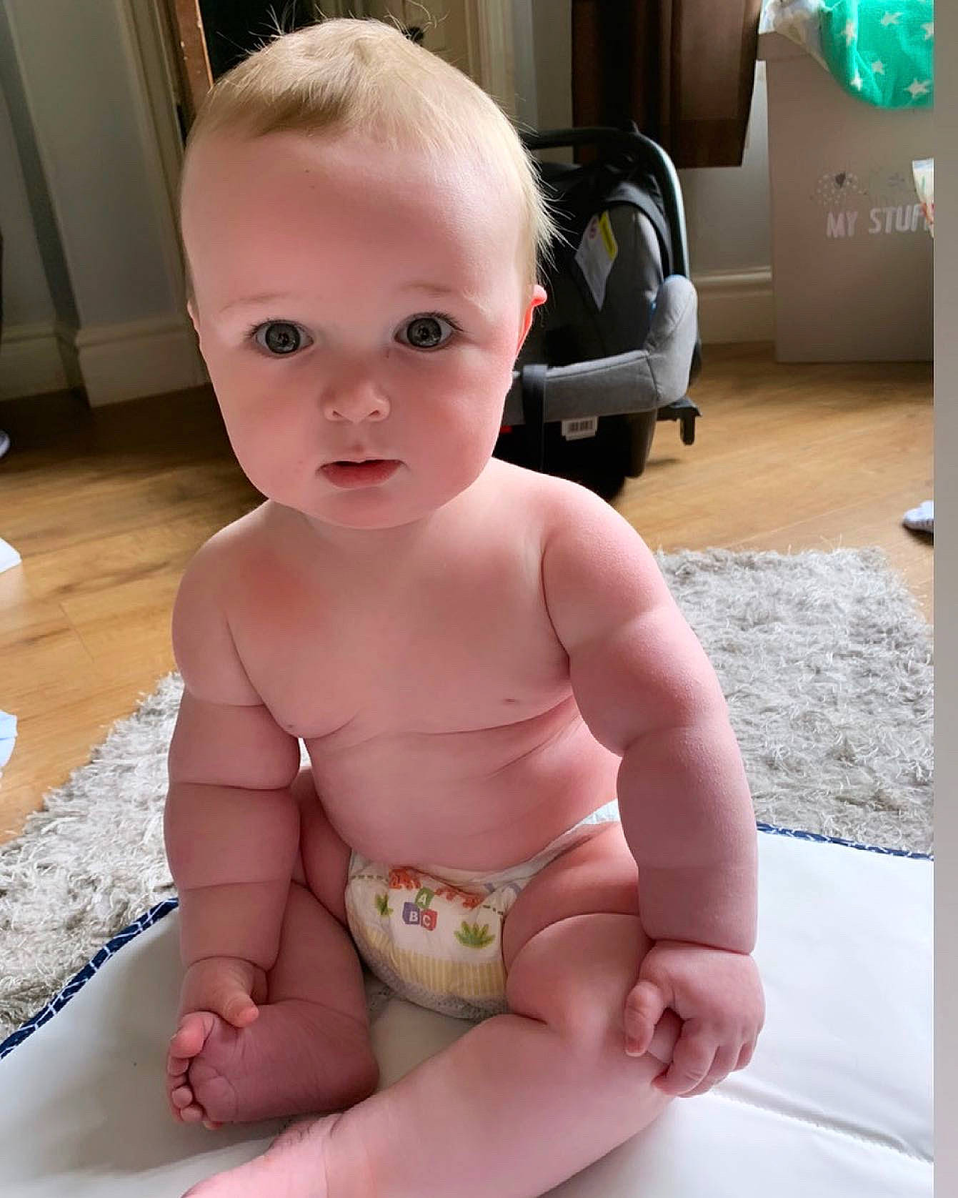 Tommy joined the competition — help win amazing prizes! arm, baby, cheek, chest, chin, eye, eyebrow, finger, hand, head, iris, lip, mouth, nose, person, skin, stomach, thigh, thumb, toddler