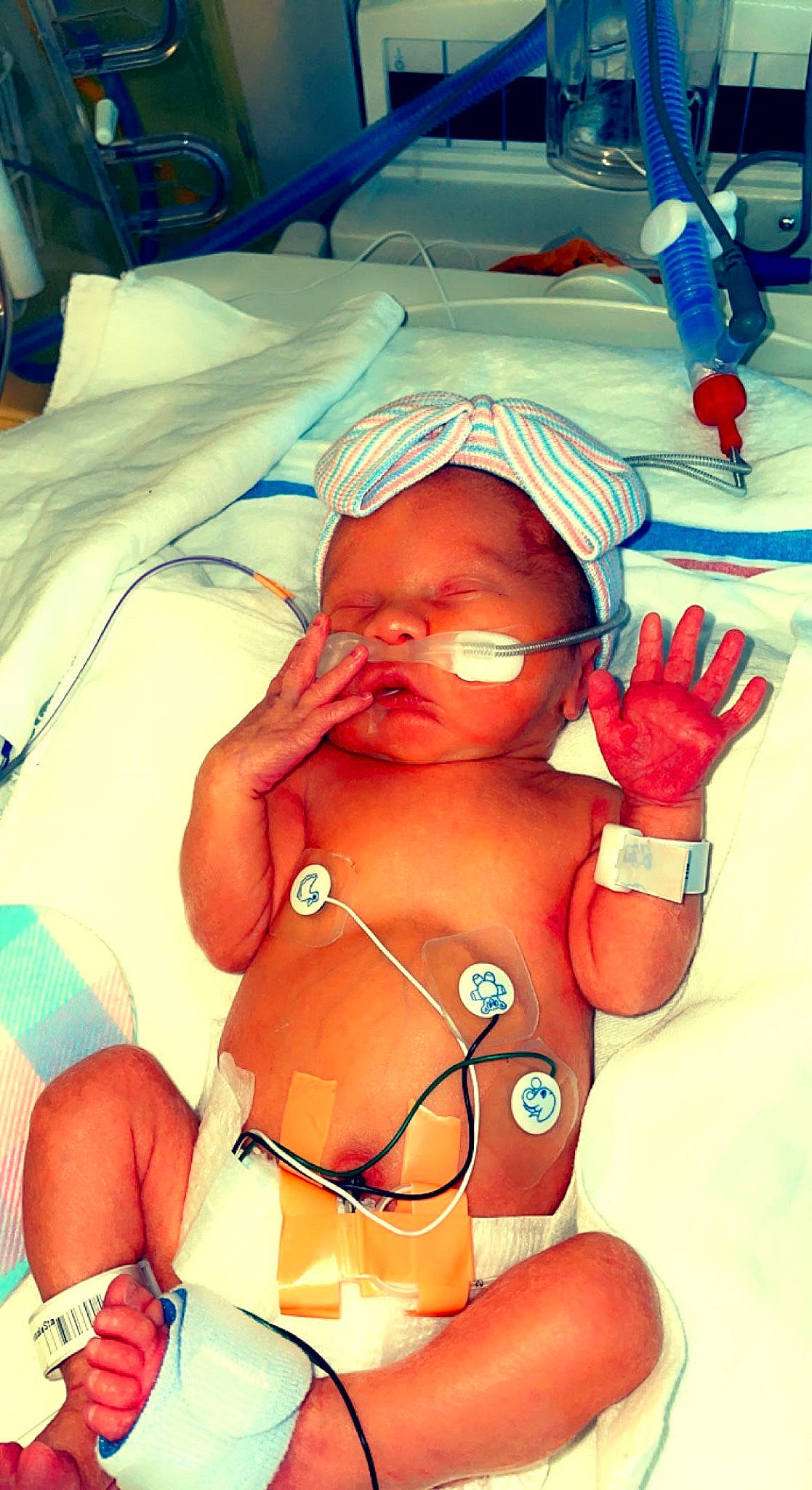 Hudson is registered to the contest to win money with this photo: abdomen, baby, chest, child, clinic, finger, fun, gesture, health_care, medical, medical_equipment, medical_procedure, mouth, patient, person, service, skin, thigh, thumb, toddler