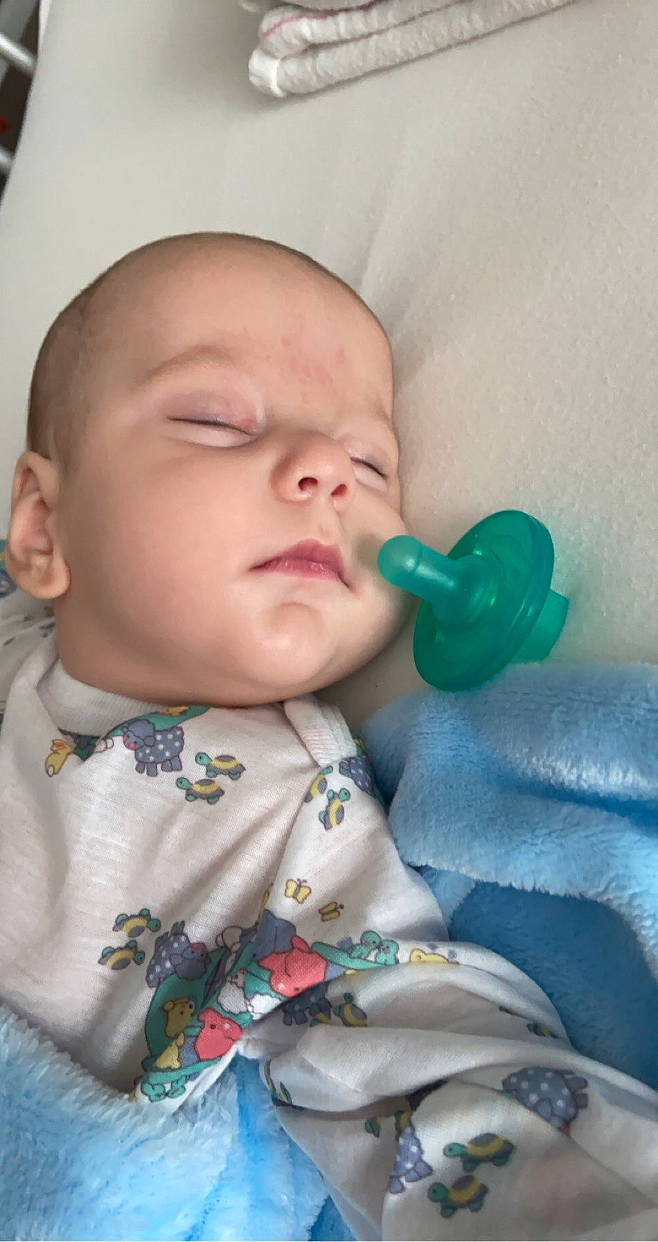 Gunner joined the competition — help win amazing prizes! baby, cheek, child, ear, face, head, mouth, nose, person, skin, toddler