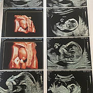Innayah a rejoint le concours — aidez-le/la à gagner de superbes lots ! ultrasound, fetus, medical, scan, pregnancy, 3d_ultrasound, 2d_ultrasound, baby, womb, prenatal, sonogram, healthcare, monitoring, hospital, document, feet, paper, black_and_white, color_ultrasound, gestation