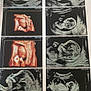 ultrasound, fetus, medical, scan, pregnancy, 3d_ultrasound, 2d_ultrasound, baby, womb, prenatal, sonogram, healthcare, monitoring, hospital, document, feet, paper, black_and_white, color_ultrasound, gestation