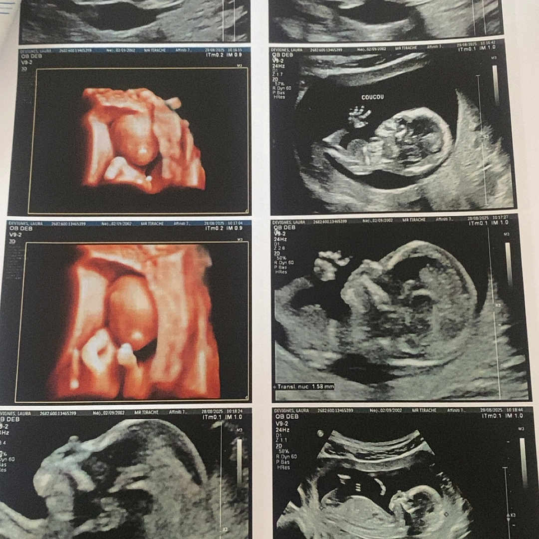 Innayah a rejoint le concours — aidez-le/la à gagner de superbes lots ! 2d_ultrasound, 3d_ultrasound, baby, black_and_white, color_ultrasound, document, feet, fetus, gestation, healthcare, hospital, medical, monitoring, paper, pregnancy, prenatal, scan, sonogram, ultrasound, womb