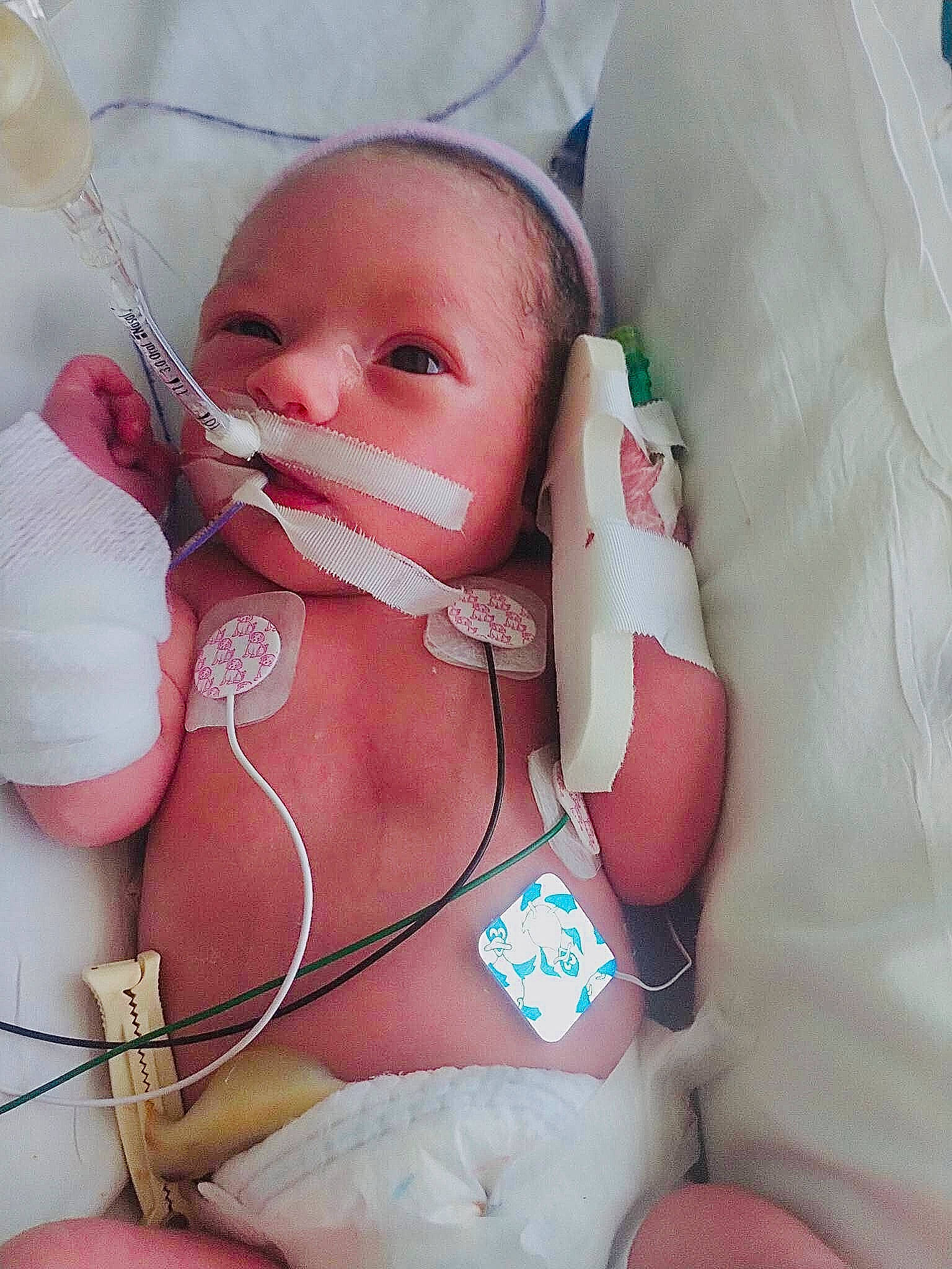 Ali joined the competition — help win amazing prizes! abdomen, baby, baby_products, baby_sleeping, baby_toddler_clothing, cheek, chest, child, comfort, eye, eyelash, finger, mouth, neck, person, pink, skin, textile, thumb, toddler