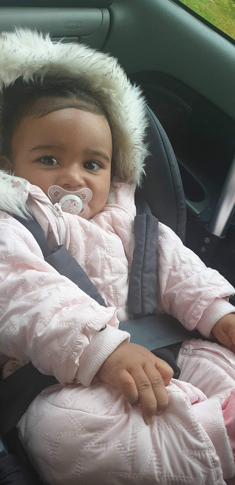 Lianna participe au concours pour gagner de l'argent avec cette photo : baby, cheek, child, nose, person, skin, toddler