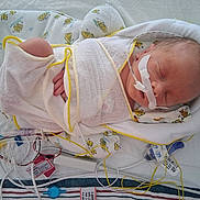 Caspen is registered to the contest to win money with this photo: newborn, baby, infant, hospital, medical_tubes, swaddled, sleeping, cushion, white_cloth, yellow_trim, face, person, healthcare, monitoring, bed, patient, cute, fragile, resting, indoors