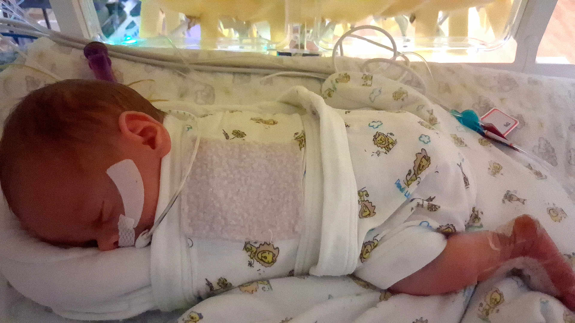 Caspen joined the competition — help win amazing prizes! baby, newborn, incubator, hospital, medical_tape, tube, sleeping, blanket, infant, cute, pattern, lion, healthcare, patient, bed, resting, child, clothing, foot, wrapped