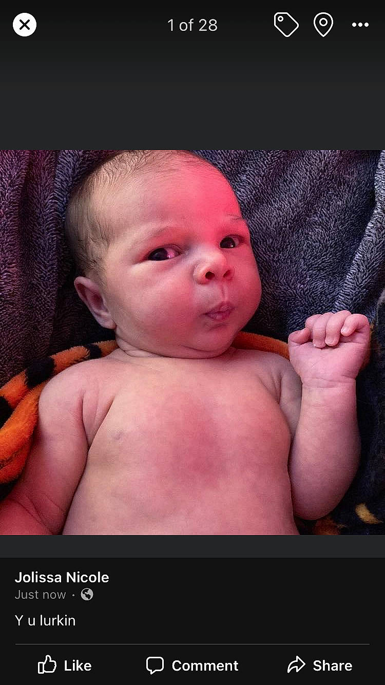 Love is registered to the contest to win money with this photo: arm, cheek, chin, comfort, eye, eyebrow, eyelash, facial_expression, human_body, jaw, joint, leg, lip, mouth, muscle, neck, nose, person, shoulder, skin