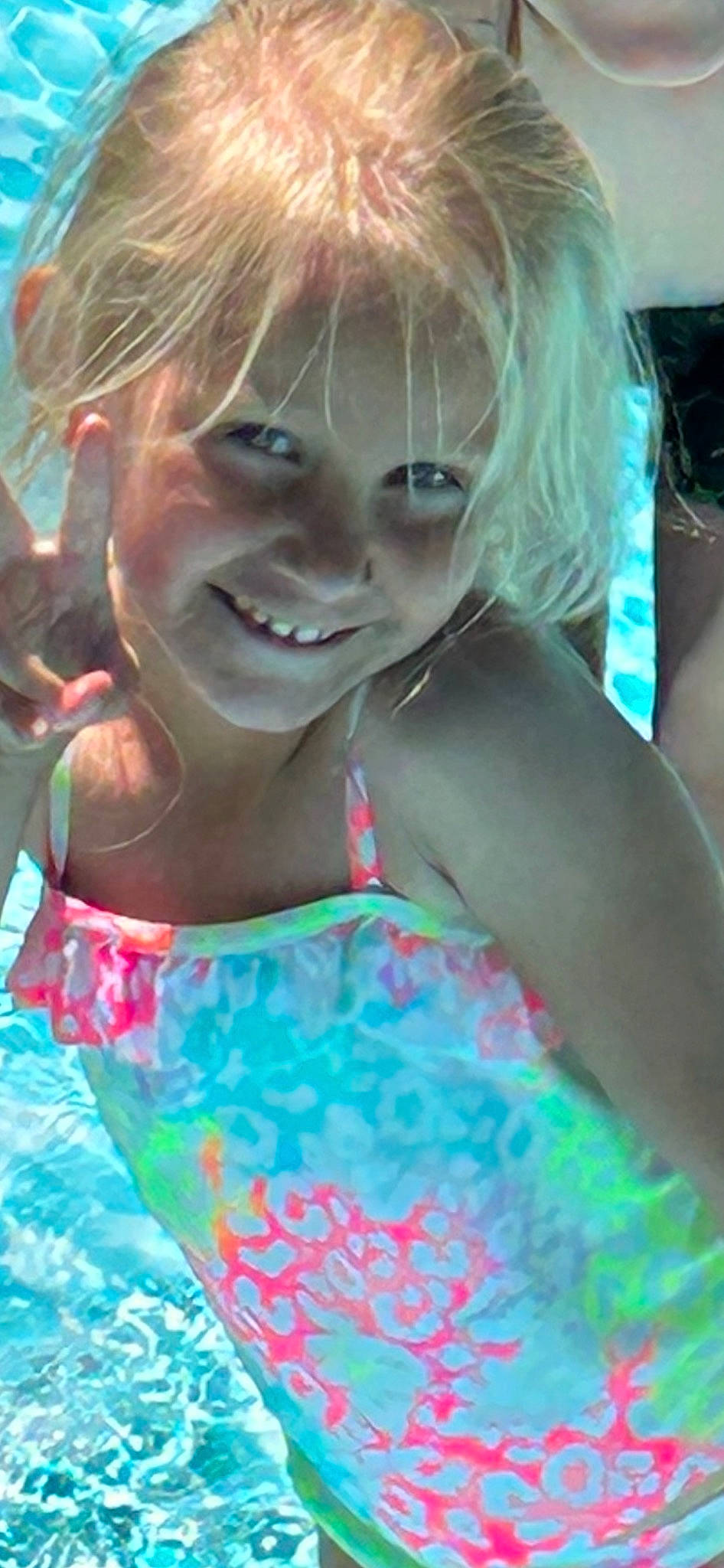 Brenley joined the competition — help win amazing prizes! bangs, chest, child, cool, dress, eyelash, eyewear, fun, grass, hair, happy, joy, leisure, lip, person, recreation, smile, summer, swimming_pool, swimwear