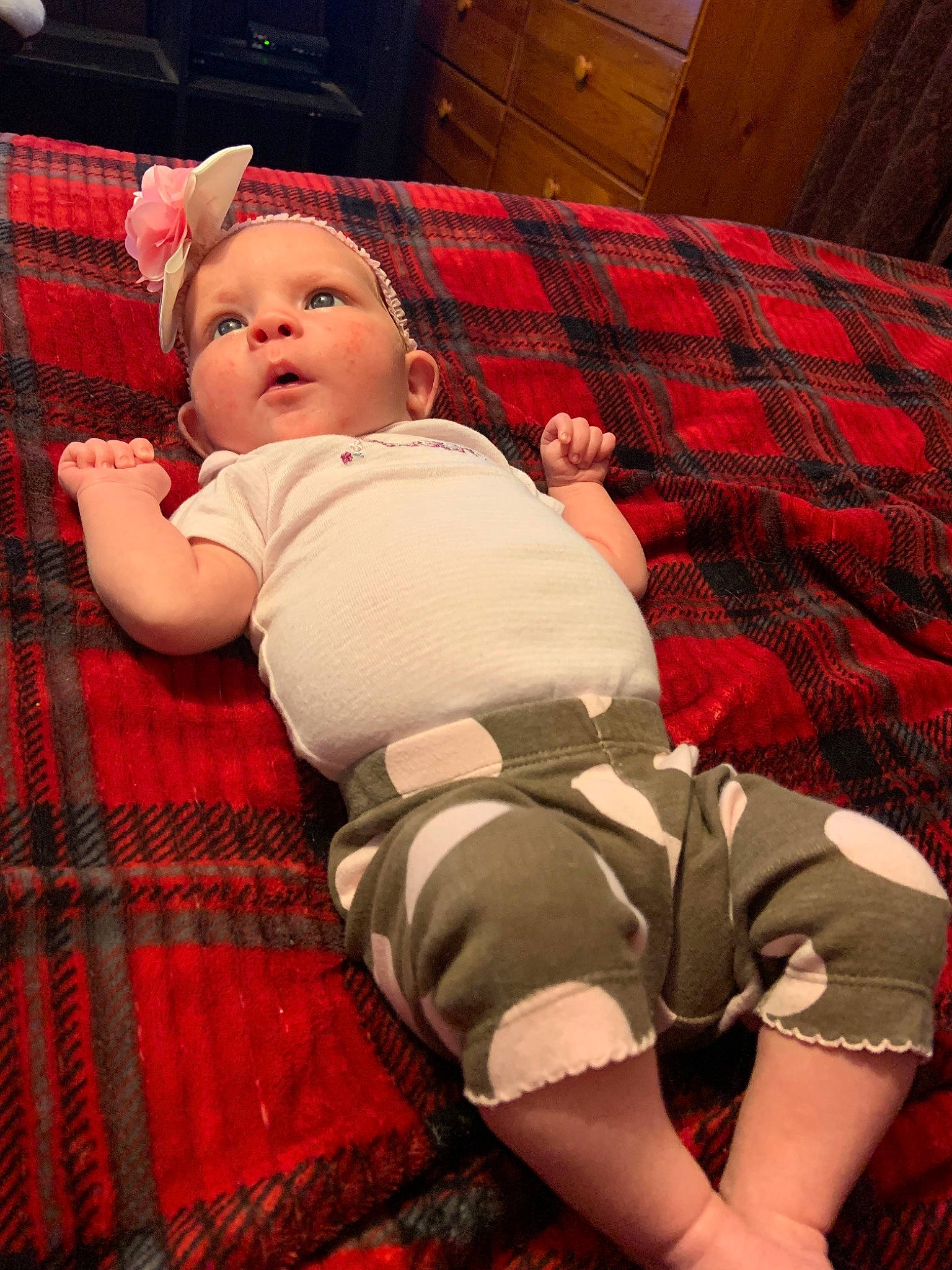 Kenzlee is registered to the contest to win money with this photo: arm, baby, cheek, child, design, leg, pattern, person, plaid, skin, tartan, textile, toddler