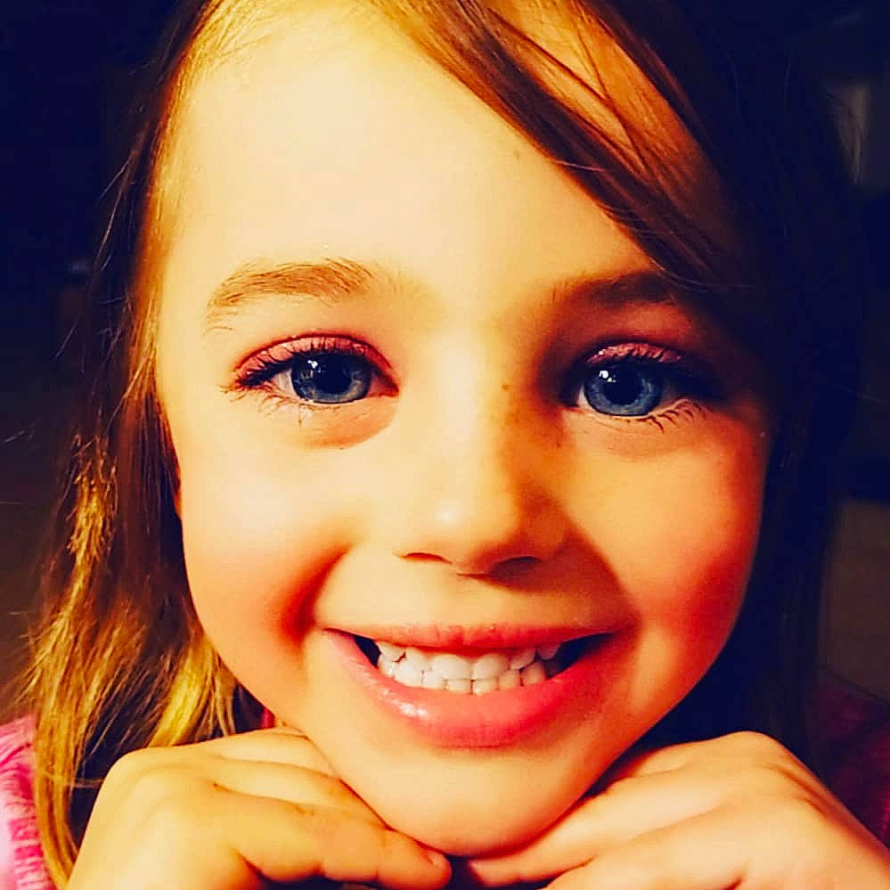 Adalie joined the competition — help win amazing prizes! beauty, cheek, child, chin, close_up, eye, eyebrow, face, facial_expression, forehead, hair, head, jaw, joy, lip, mouth, nose, organ, person, skin