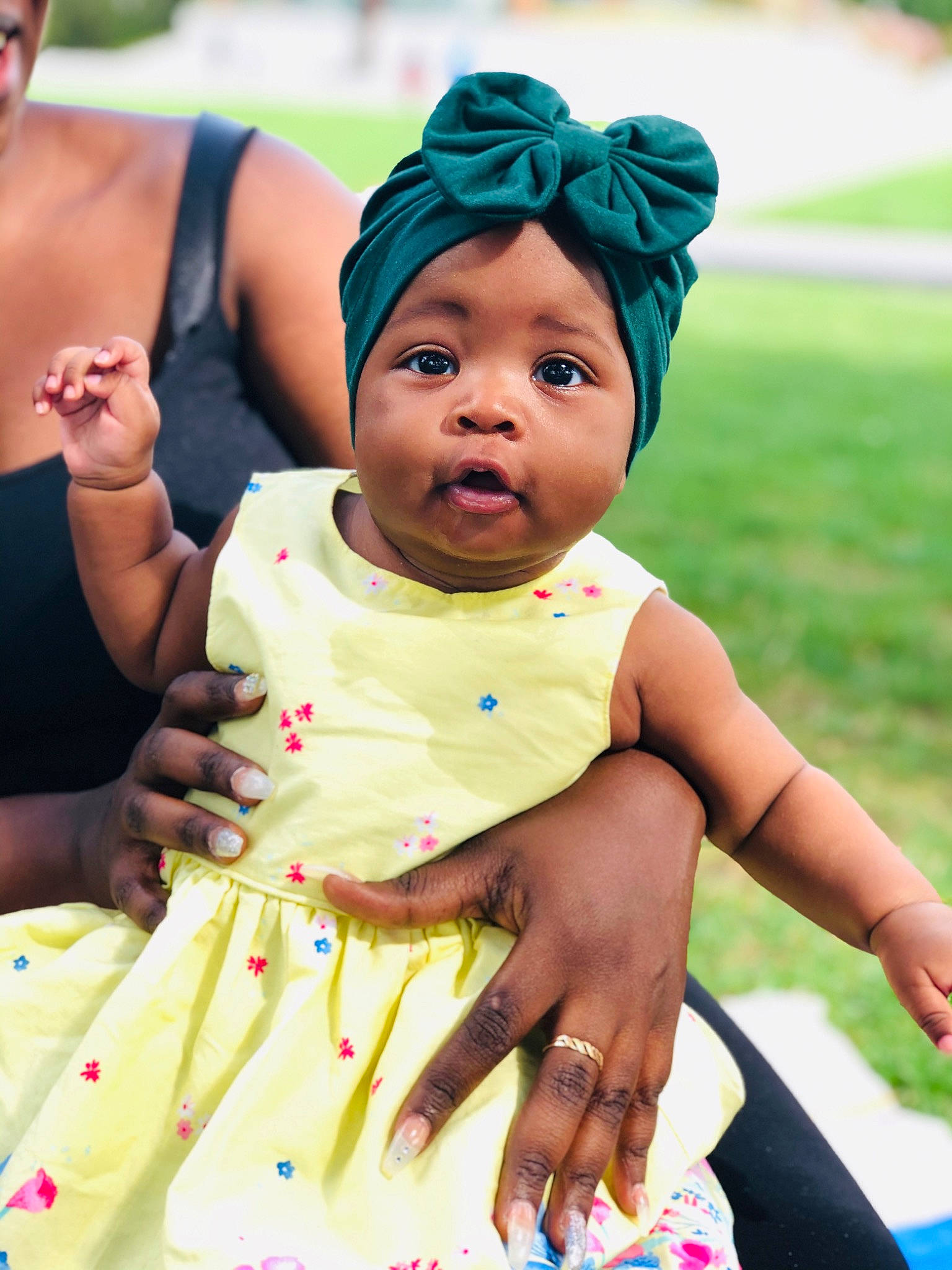 Atouma participe au concours pour gagner de l'argent avec cette photo : adaptation, baby, birthday, child, hair_accessory, happy, headband, headgear, headwear, party, person, pink, play, skin, smile, summer, toddler, yellow