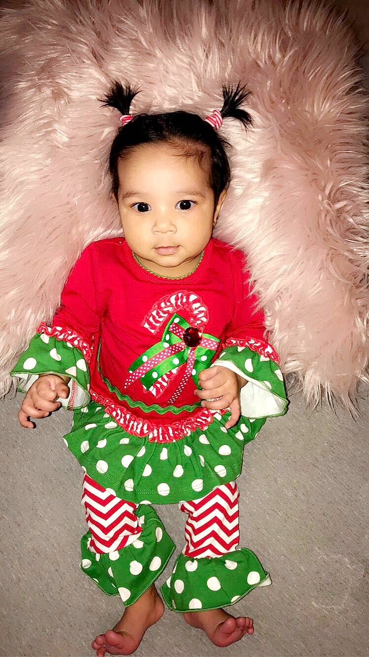 Letty joined the competition — help win amazing prizes! animal_product, baby, baby_toddler_clothing, cheek, child, christmas, costume, costume_accessory, fur, hair_accessory, natural_material, nose, person, polka_dot, sock, textile, toddler