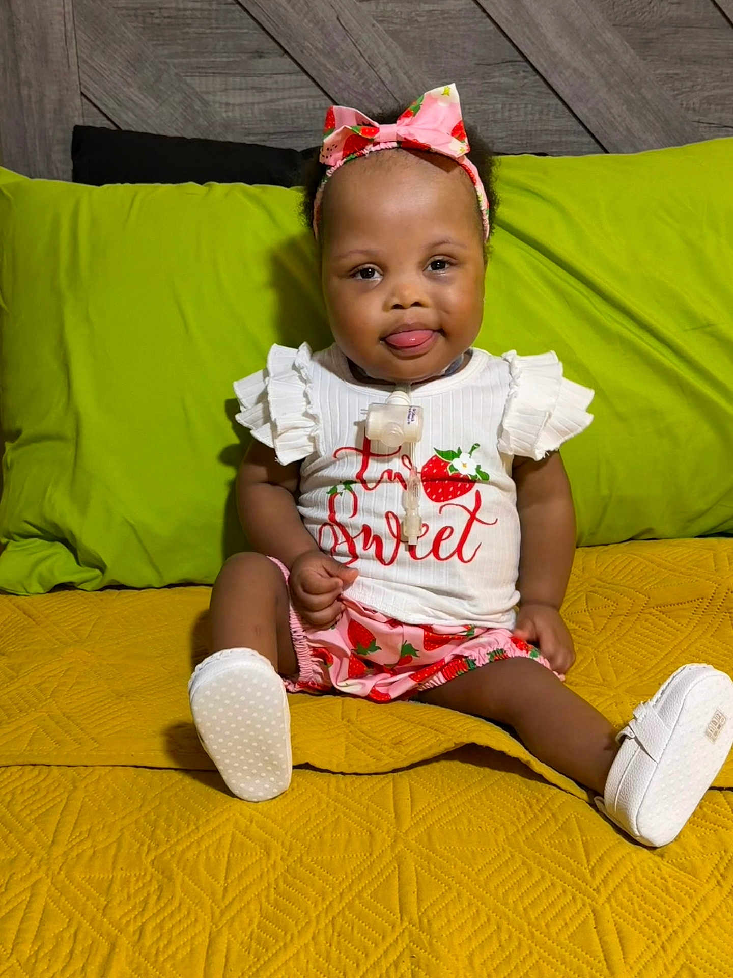 Elyse joined the competition — help win amazing prizes! baby, child, girl, sitting, smiling, headband, bow, strawberry, white_top, shorts, yellow_quilt, green_pillow, medical_device, indoors, cute, portrait, happy, clothing, person, feet