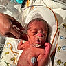 baby, blanket, care, closeup, diaper, fragile, hand, healthcare, hospital, infant, lion_pattern, medical_tubes, monitoring_electrodes, newborn, nursery, person, premature, skin, sleeping, tender