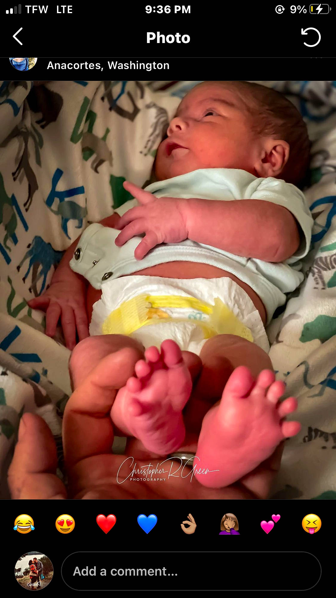 Cayde is registered to the contest to win money with this photo: abdomen, baby, baby_toddler_clothing, cheek, child, comfort, event, eye, finger, foot, gesture, hand, happy, muscle, nail, pattern, person, skin, stomach, thumb