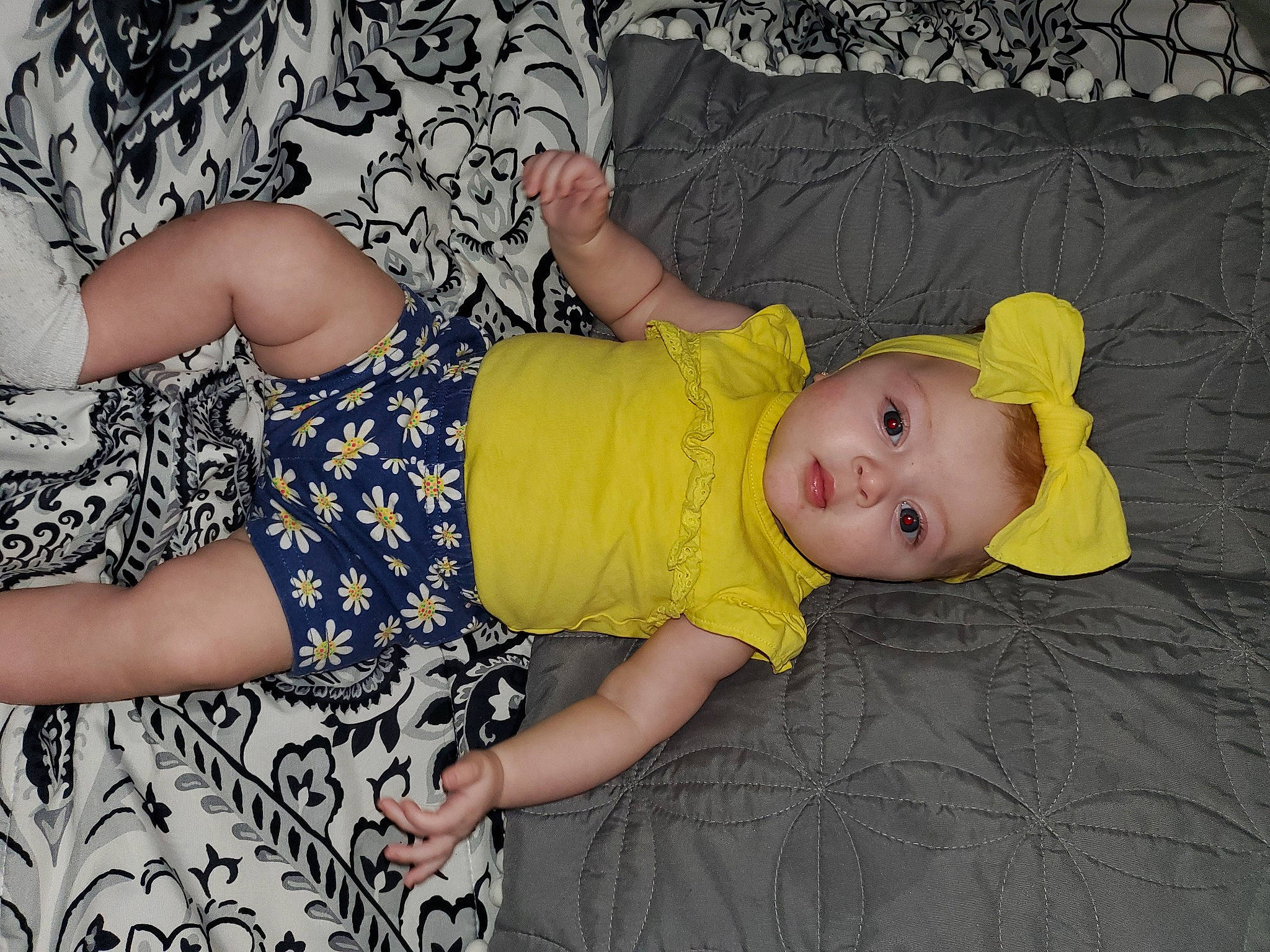 Avalina joined the competition — help win amazing prizes! baby, baby_toddler_clothing, cheek, child, comfort, dress, facial_expression, finger, fun, grass, head, human_body, human_leg, leg, mammal, pattern, person, skin, textile, thigh