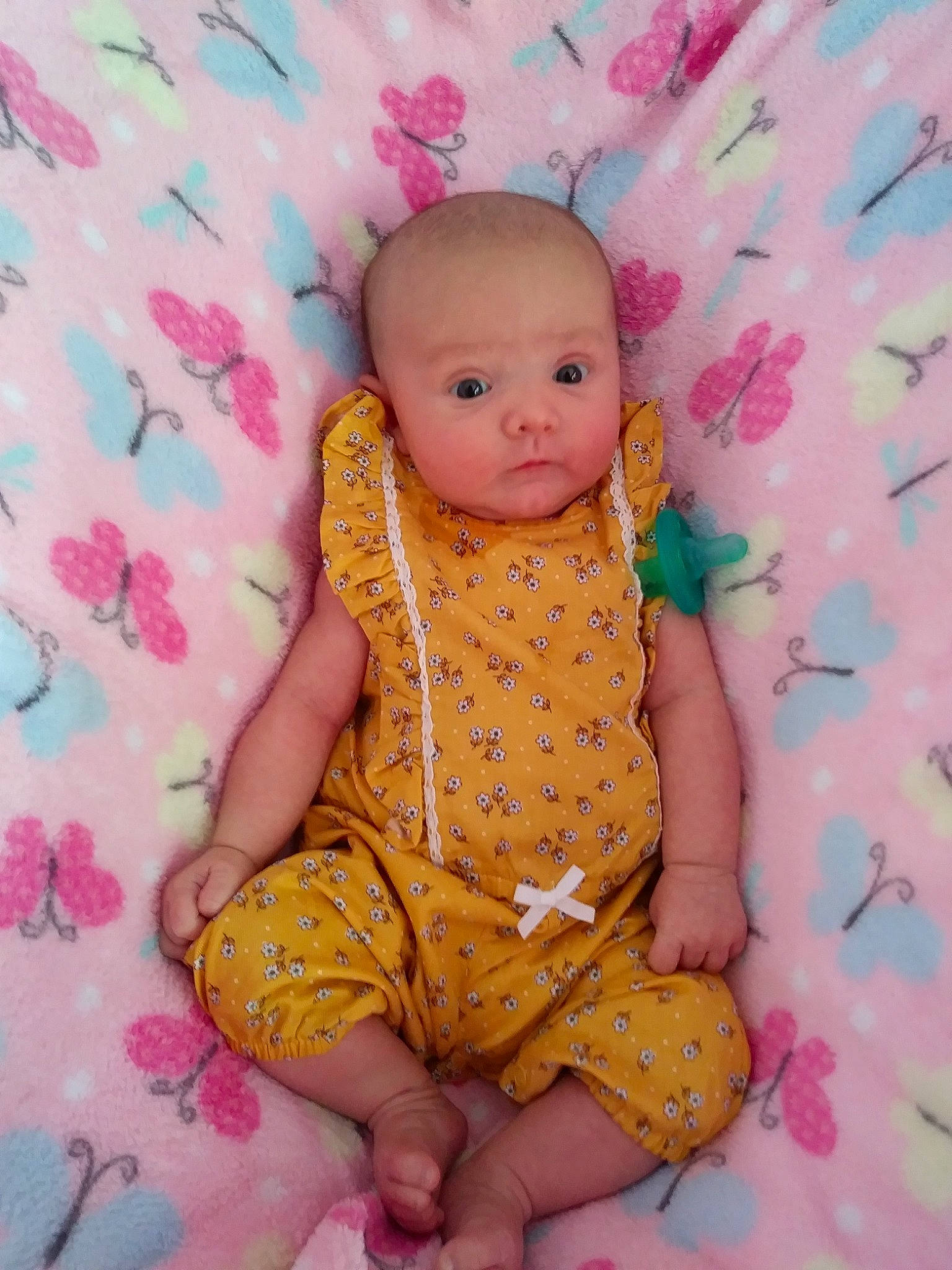 Alexis is registered to the contest to win money with this photo: baby, baby_toddler_clothing, cheek, child, dress, pattern, person, pink, sitting, skin, toddler, yellow