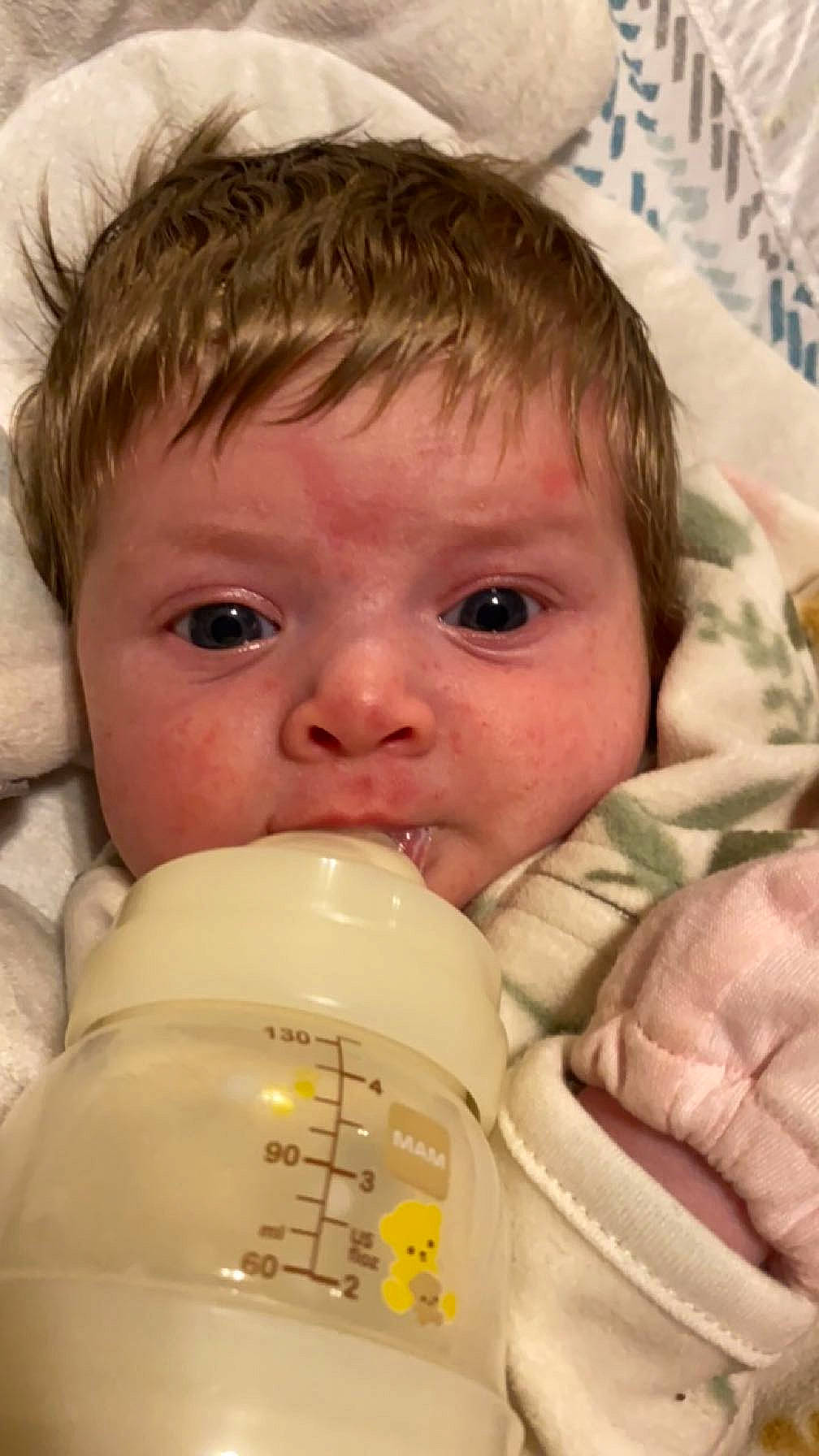 Esther joined the competition — help win amazing prizes! baby, baby_bottle, cheek, child, chin, close_up, drinkware, eye, eyebrow, eyelash, face, facial_expression, forehead, iris, lip, mouth, nose, organ, person, skin