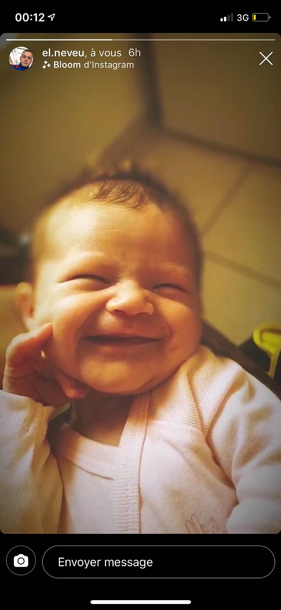 Maluna participe au concours pour gagner de l'argent avec cette photo : baby, baby_laughing, cheek, child, chin, close_up, ear, face, facial_expression, forehead, fun, happy, head, joy, laugh, lip, mouth, nose, person, skin