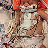 baby, infant, medical_tubes, hospital, monitoring, diaper, electrodes, smiley_face, teddy_bear_tape, bandages, sleeping, medical_equipment, wires, intensive_care, baby_care, healthcare, patient, newborn, medical_tape, hospital_bed