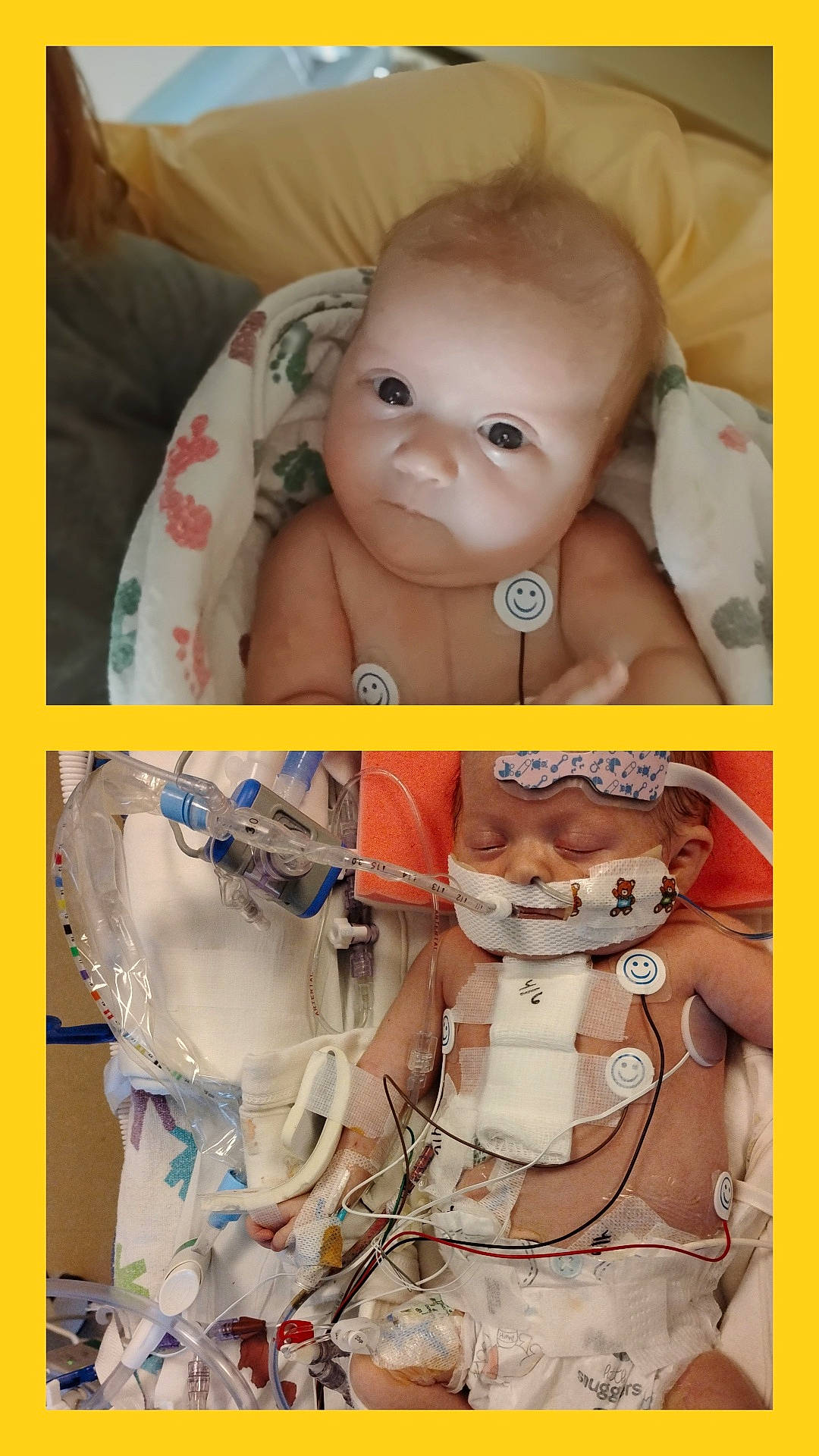 Wylee is registered to the contest to win money with this photo: baby, blanket, care, child, cute, face, healthcare, hospital, hospital_bed, infant, medical_care, medical_equipment, monitoring, newborn, patient, person, sleeping, tubes, vulnerable, wires