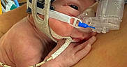 Emma is registered to the contest to win money with this photo: newborn, baby, medical_mask, hospital, infant, headgear, breathing_tube, skin, hand, person, healthcare, closeup, resting, medical_equipment, intensive_care, fragile, support, child, care, hospital_room