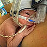 newborn, baby, medical_mask, hospital, infant, headgear, breathing_tube, skin, hand, person, healthcare, closeup, resting, medical_equipment, intensive_care, fragile, support, child, care, hospital_room