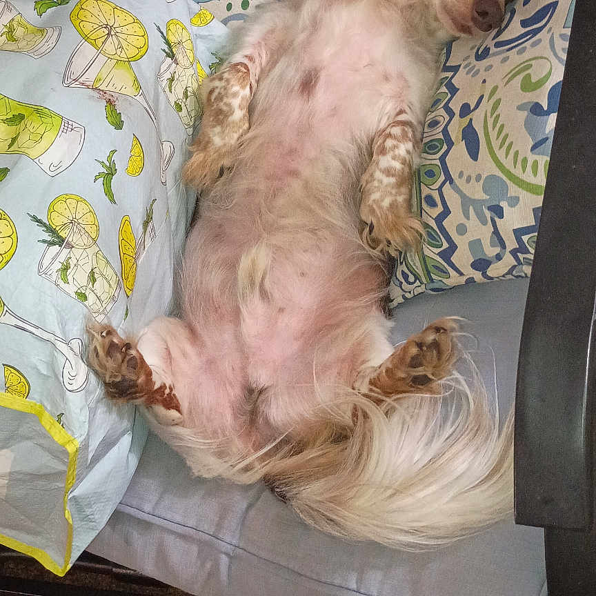 Watson