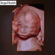 Valeria is registered to the contest to win money with this photo: ultrasound, 3d_ultrasound, fetus, prenatal, medical_image, baby, healthcare, scan, womb, pregnancy, human, face, head, body, clinic, technology, diagnostic, health, gestation, medical_equipment