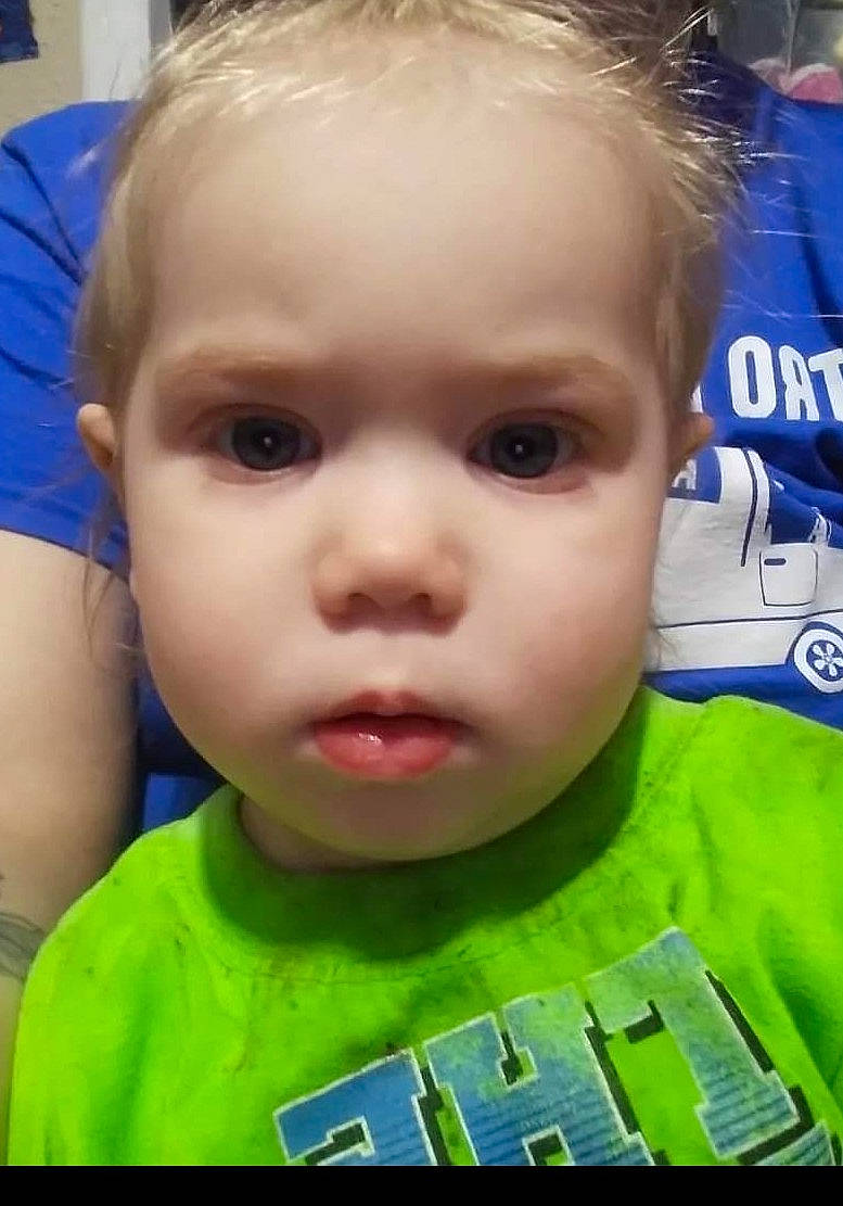 Valkyrie joined the competition — help win amazing prizes! baby, blue, cheek, chin, cool, ear, eyebrow, eyelash, facial_expression, forehead, grass, hairstyle, happy, iris, mouth, nose, organ, person, photograph, skin