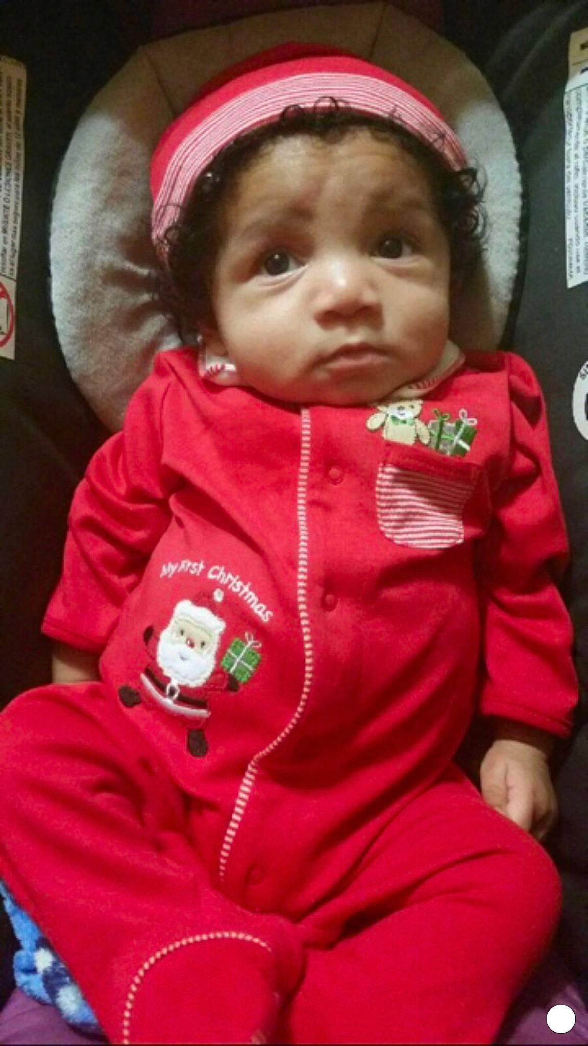 Xzayvion is registered to the contest to win money with this photo: baby, baby_products, baby_toddler_clothing, bonnet, cheek, child, costume_accessory, fur, headband, headgear, lip, person, skin, sleeve, toddler