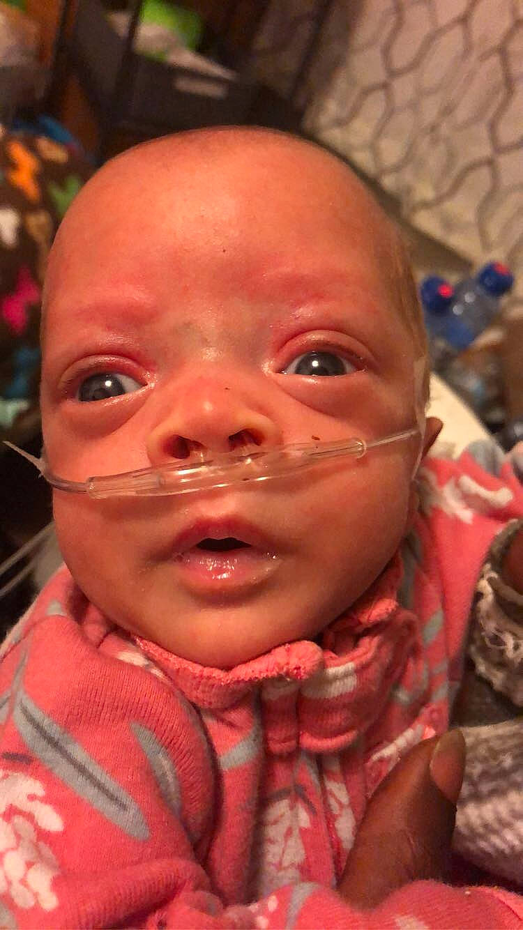 Aiyana joined the competition — help win amazing prizes! baby, beauty, cheek, ear, event, eyebrow, eyelash, forehead, fun, happy, iris, jaw, lip, mouth, nose, organ, person, skin, smile, toddler