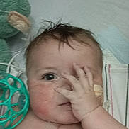 Dylan is registered to the contest to win money with this photo: baby, infant, child, hand, face, cheek, hair, medical_bandage, scar, toy, blanket, bed, playful, cute, skin, lying_down, close_up, expression, indoors, soft_toy