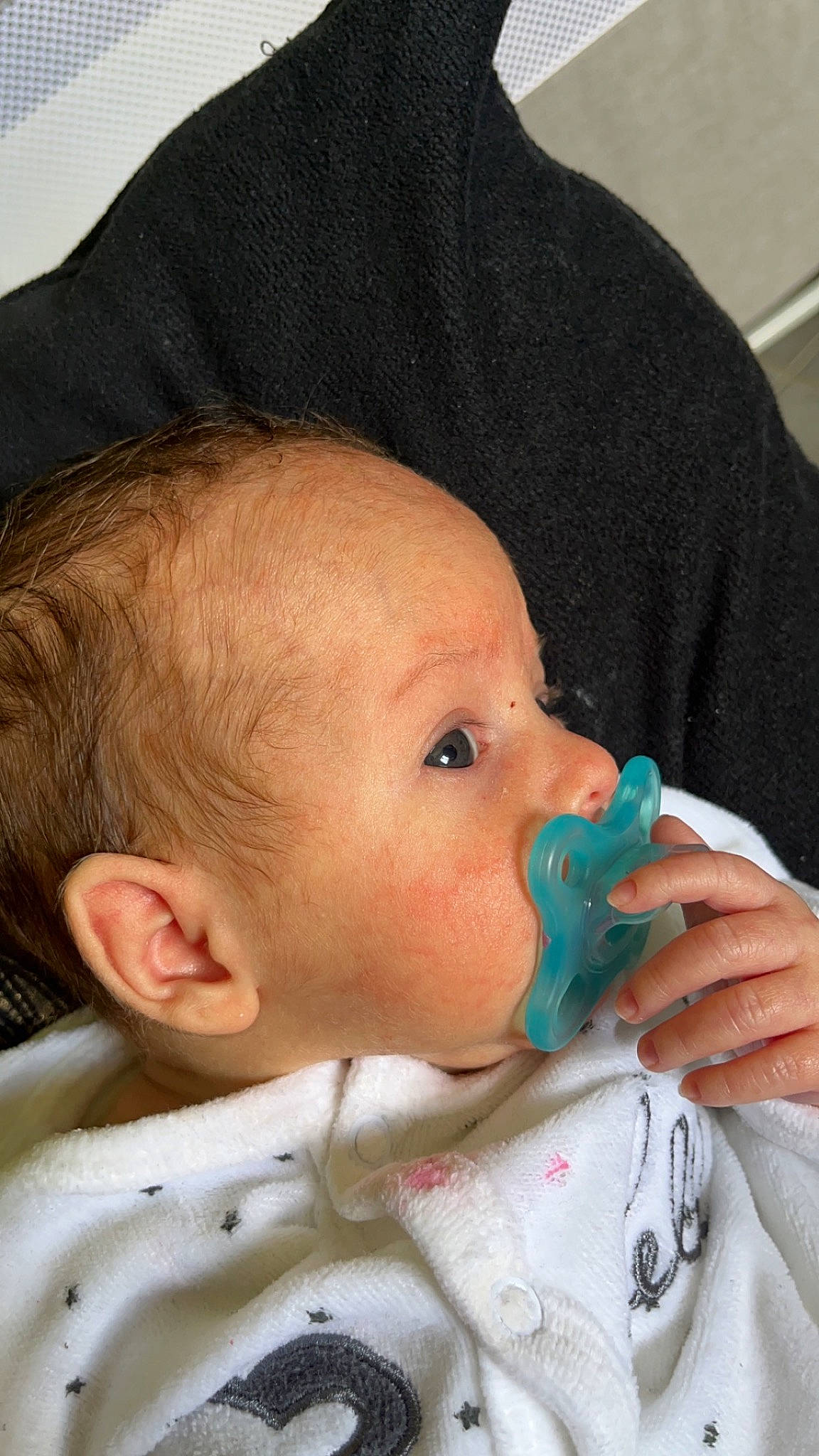 Gianni participe au concours pour gagner de l'argent avec cette photo : baby, baby_toddler_clothing, cheek, child, chin, drinkware, ear, eyebrow, eyelash, face, forehead, human_body, iris, lip, mouth, nail, neck, nose, person, skin