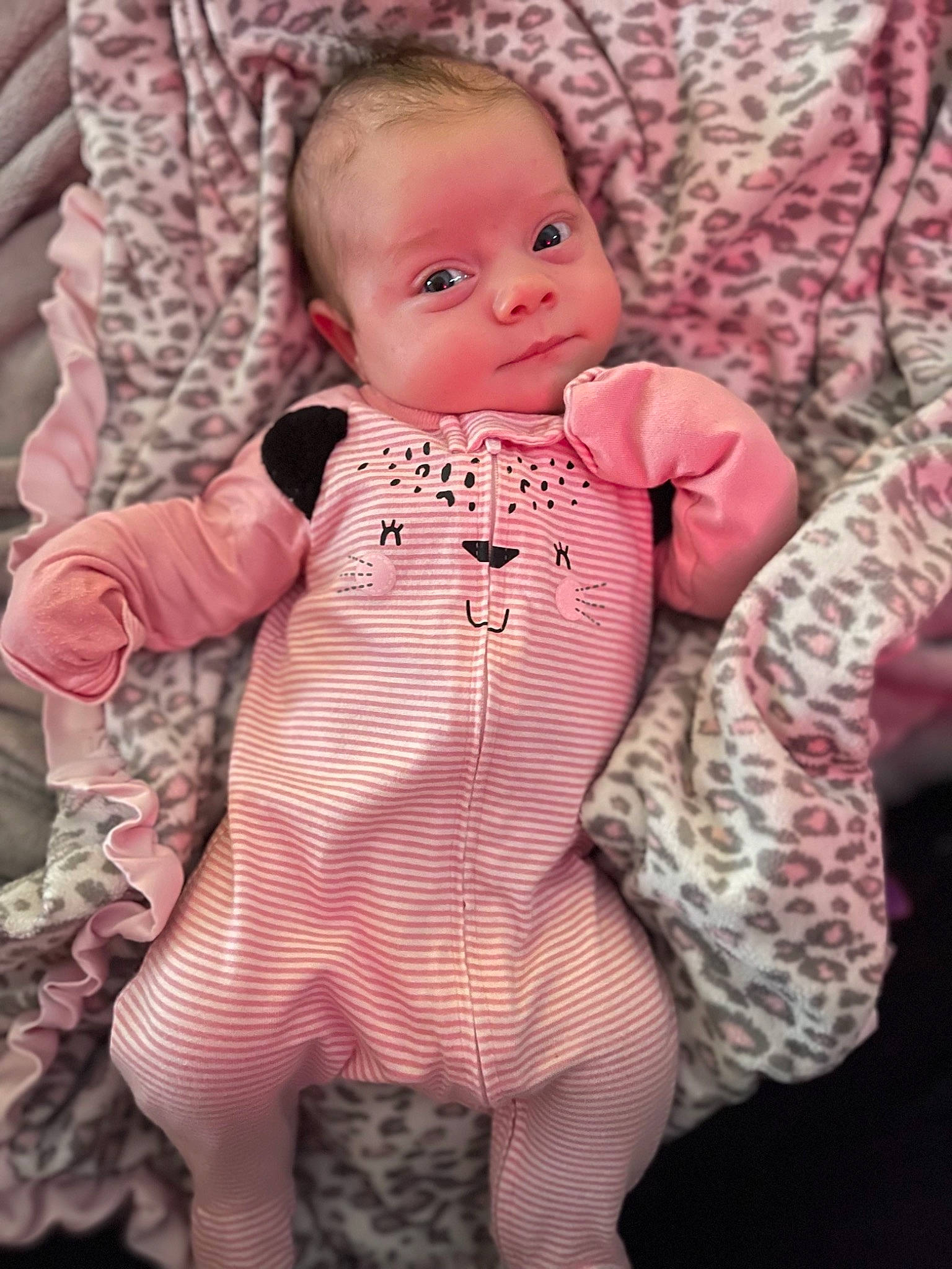 Anya joined the competition — help win amazing prizes! baby, baby_toddler_clothing, cheek, collar, comfort, dress, eye, face, finger, hand, head, lip, neck, outerwear, pattern, person, pink, skin, sleeve, textile