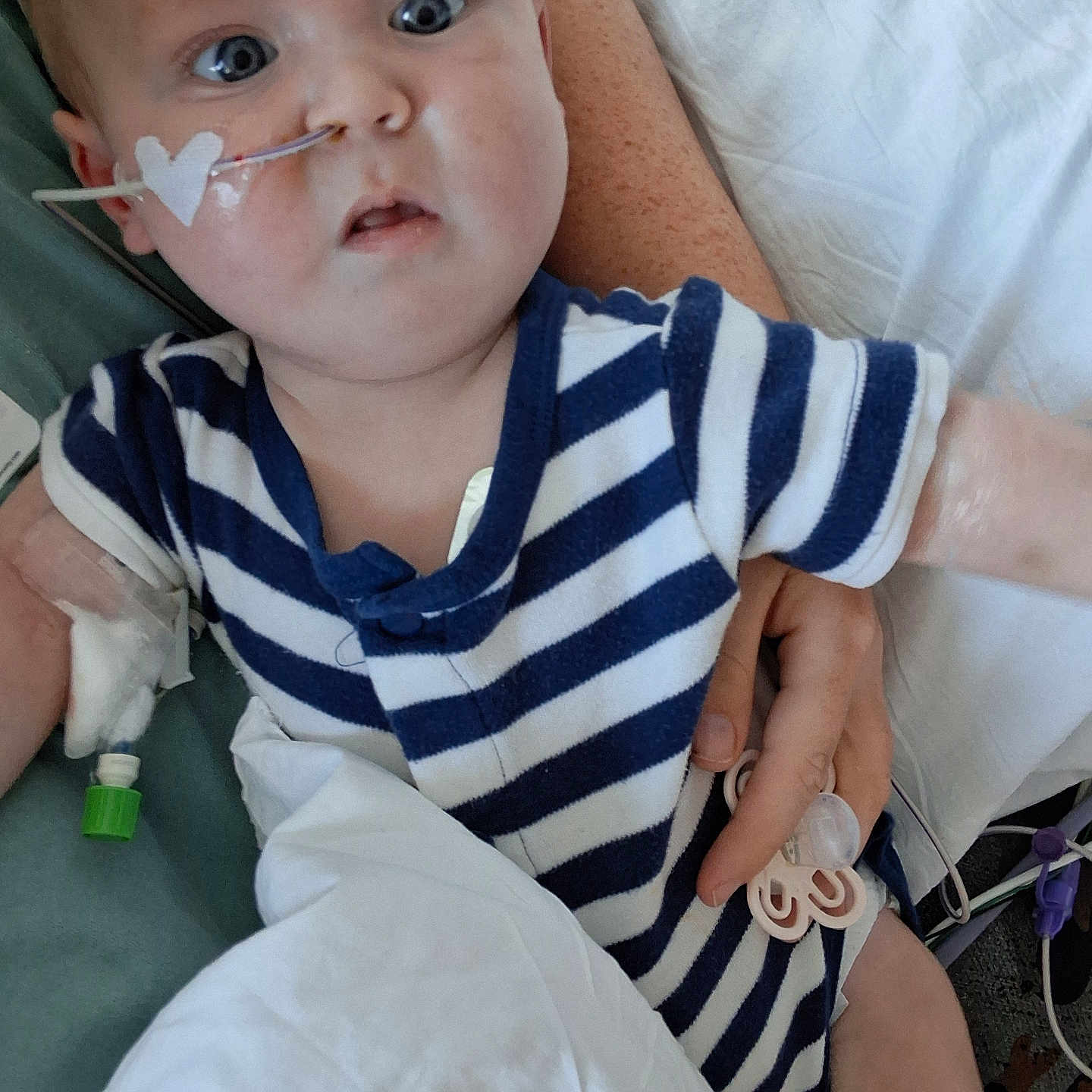 Ryder joined the competition — help win amazing prizes! baby, child, striped_clothing, onesie, hospital, medical_tube, nasal_tube, heart_shaped_tape, arm_bandage, blanket, hand, bed, person, infant, medical_equipment, patient, lying_down, caregiver, room, healthcare