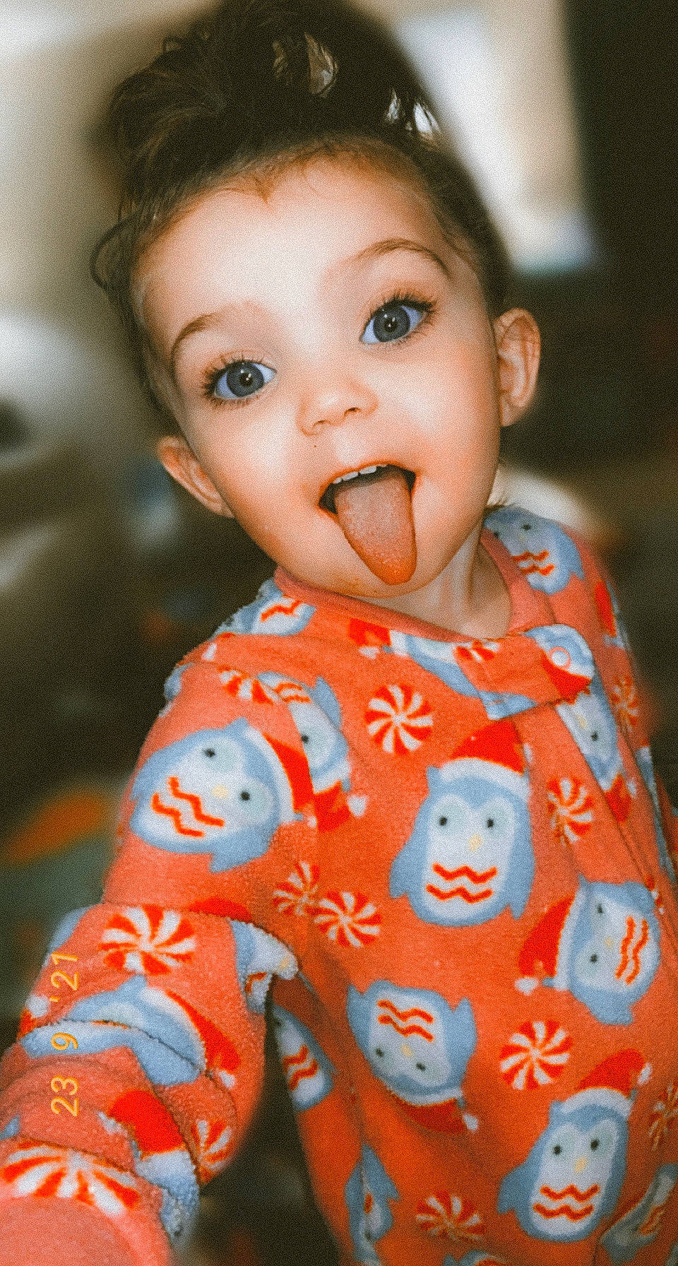 Legend joined the competition — help win amazing prizes! arm, baby_toddler_clothing, cheek, chin, dress, eye, eyelash, face, forehead, head, human_body, iris, lip, mouth, neck, nose, orange, organ, person, skin