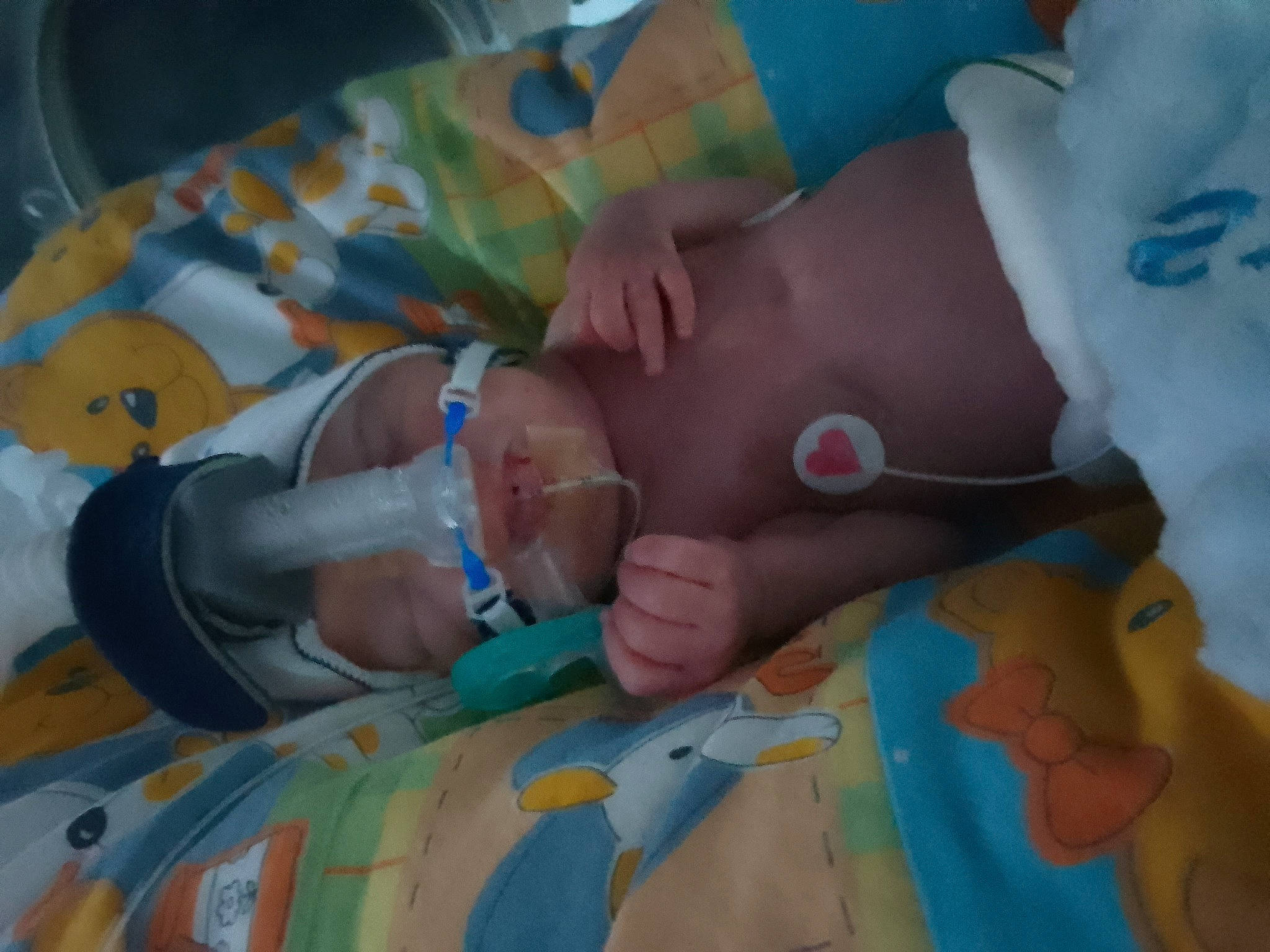 Alfie joined the competition — help win amazing prizes! arm, azure, baby, baby_products, baby_toddler_clothing, cheek, chest, child, finger, hand, head, human_body, linens, mouth, muscle, person, product, skin, textile, toddler