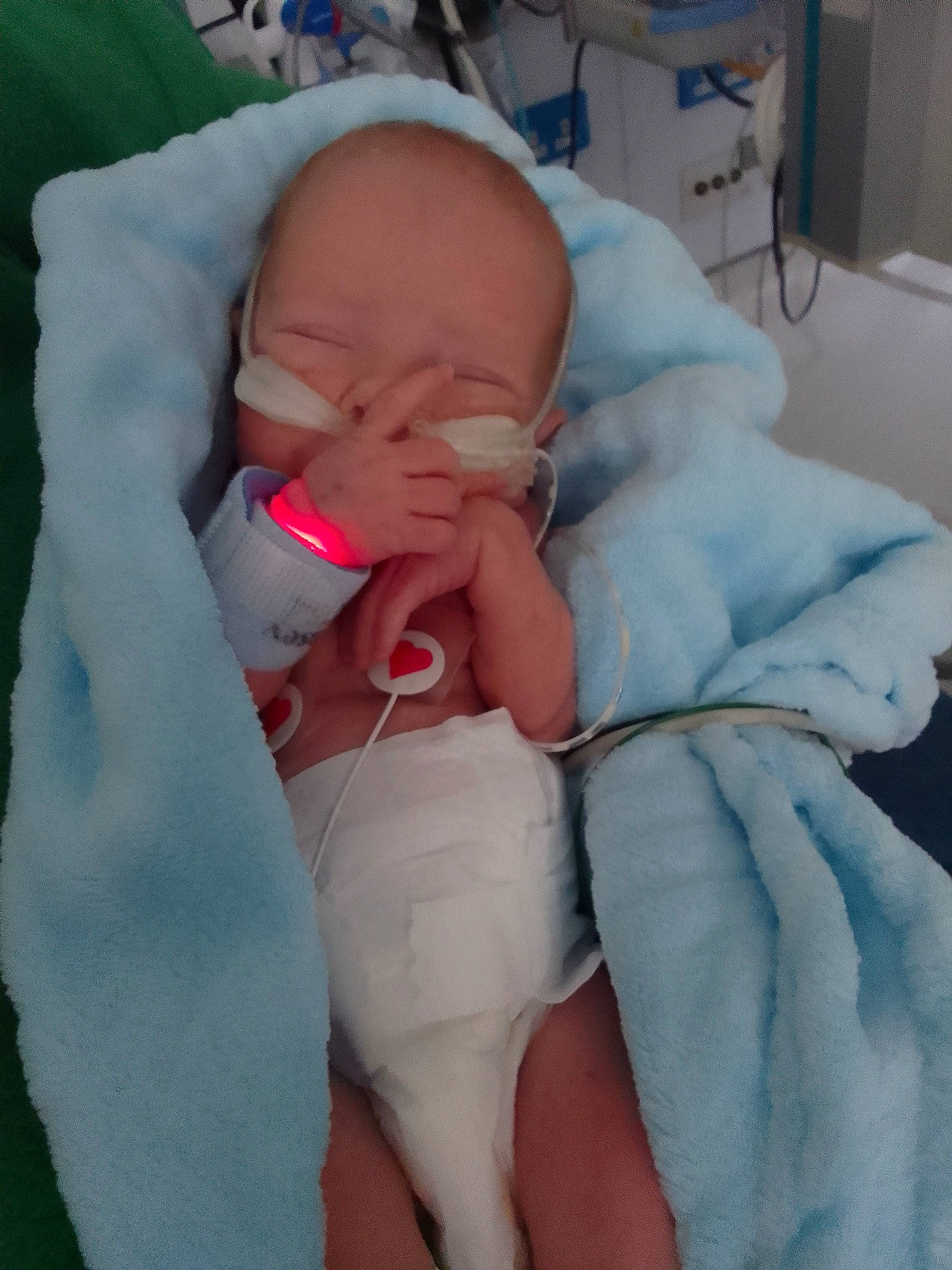 Alfie is registered to the contest to win money with this photo: abdomen, baby, baby_products, baby_sleeping, baby_toddler_clothing, cheek, chest, child, comfort, finger, flesh, head, human_leg, linens, nail, person, room, skin, stomach, thumb