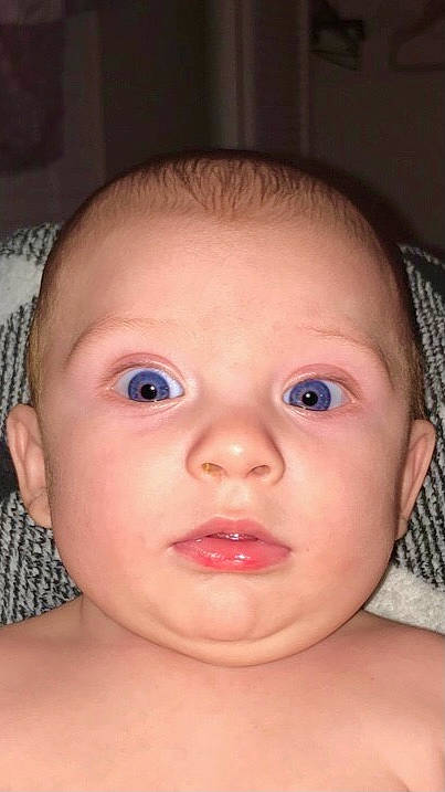 Corey is registered to the contest to win money with this photo: azure, baby, cheek, chin, ear, eyebrow, eyelash, facial_expression, finger, forehead, happy, iris, jaw, lip, mouth, neck, nose, person, skin, toddler