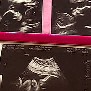 Tatiana joined the competition — help win amazing prizes! baby, black_and_white, clinic, diagnostic, fetus, gestation, grainy, healthcare, human_body, medical_equipment, medical_image, monitoring, pink_border, pregnancy, prenatal, scan, sonogram, technology, ultrasound, womb