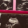 baby, black_and_white, clinic, diagnostic, fetus, gestation, grainy, healthcare, human_body, medical_equipment, medical_image, monitoring, pink_border, pregnancy, prenatal, scan, sonogram, technology, ultrasound, womb