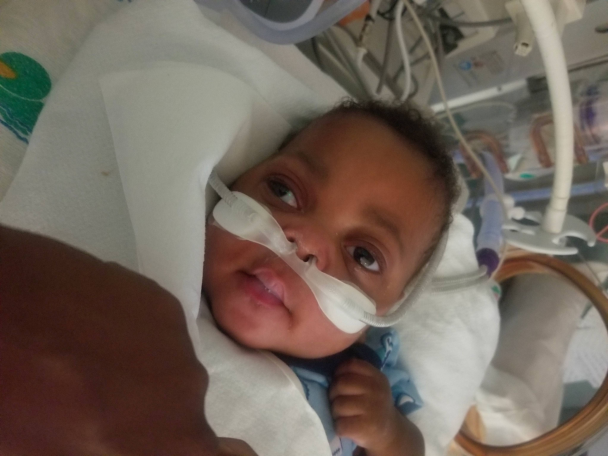 Aaron joined the competition — help win amazing prizes! baby, baby_safety, cheek, child, chin, comfort, ear, eyebrow, eyelash, gesture, hospital, iris, jaw, linens, medical_equipment, mouth, nose, person, skin, thumb