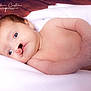 baby, infant, newborn, cleft_lip, lying_down, blue_eyes, skin, soft_blanket, close_up, portrait, child, cute, human, young, head, face, arm, hand, resting, indoors